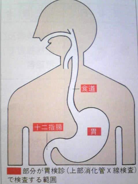 胃X線検査部位